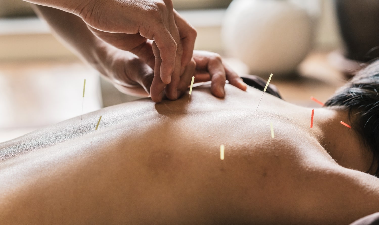 Quand aller voir un médecin acupuncteur ?